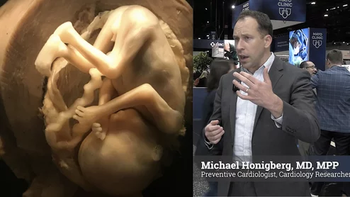 Michael Honigberg, MD, MPP, a preventive cardiologist and cardiovascular researcher at Massachusetts General Hospital, explains how preeclampsia and gestational hypertension during pregnancy can elevate cardiovascular risks later in life and how to best manage these patients.