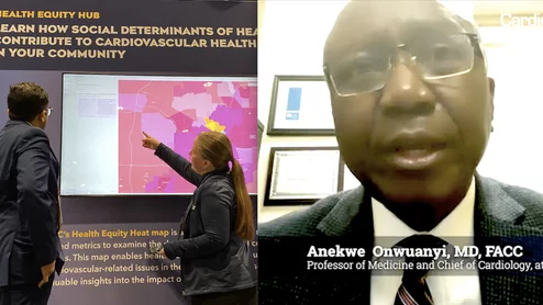 Anekwe Onwuanyi, MD, FACC, American Heart Association volunteer, Professor of Medicine and Chief of Cardiology, at Morehouse School of Medicine, medical director, heart failure program, Grady Memorial Hospital, moderated a joint session at the European Society of Cardiology with European and Egyptian cardiologists on how to close outcome gaps in cardiovascular care in ethnically diverse populations.