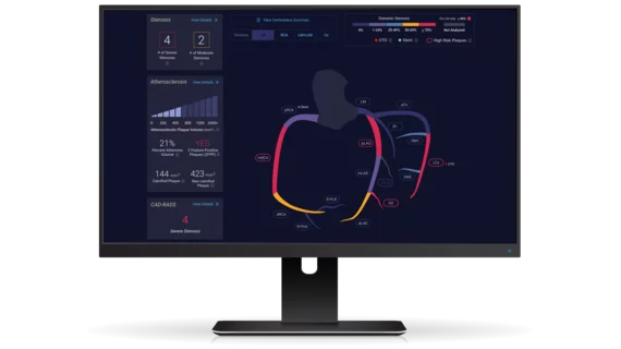 AI cardiology vendor Cleerly offers an FDA-cleared coronary artery soft plaque assessment. 