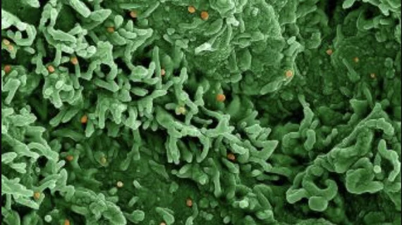 Colorized scanning electron micrograph of monkeypox virus (orange) on the surface of infected VERO E6 cells (green). Credit: NIAID