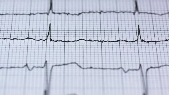 heart health attack cardiology