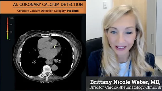  Brittany Nicole Weber, MD, Brigham and Women's Hospital, explains the use of opportunistic CT screening for cardiovascular disease on noncardiac exams. 