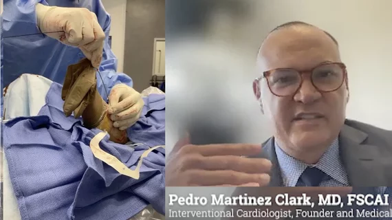 Video interview with Pedro Martinez Clark, MD, an interventional cardiologist, who explains how he overcame some key health disparities in Miami to make sure minority patients in low-income neighborhoods could receive screenings and care for peripheral artery disease (PAD).